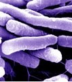 FSIS and beef industry praised for pre-emptive E.coli action