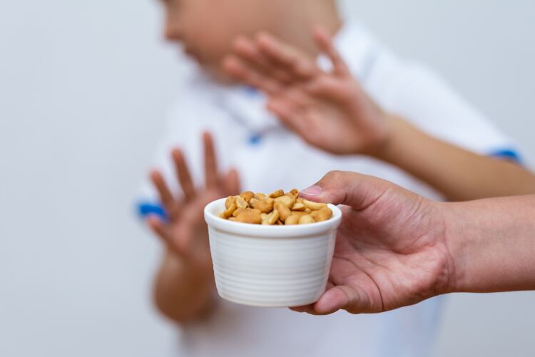 Scientists working to ‘reverse’ food allergies with microbiome breakthrough 