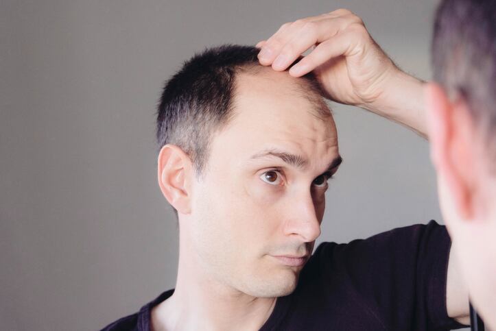 More fat means less hair, study suggests