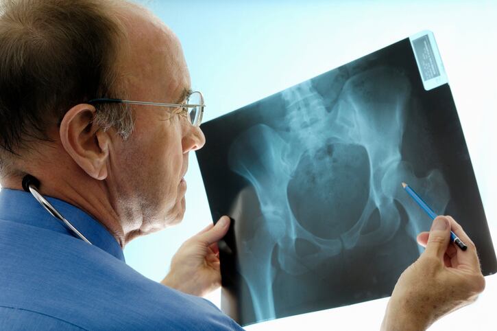 CRN disputes wide ranging conclusions drawn from Vitamin D bone health analysis