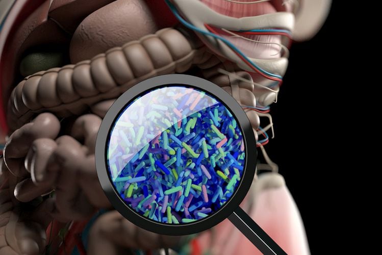 What does a healthy gut look like?