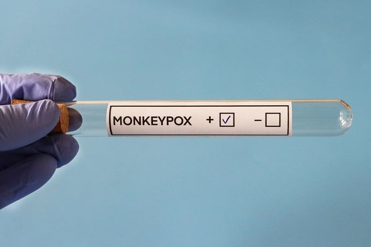 Can-monkeypox-virus-be-transmitted-via-food-Experts-aren-t-ruling-it-out.jpg