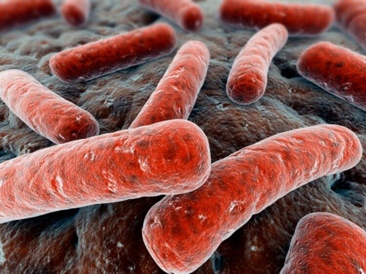 US-based Cargill recalls ground meat over e-coli scare