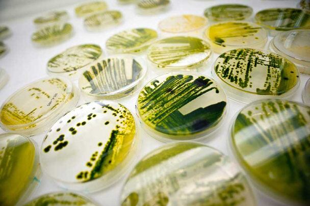 solazyme-petri-dishes-new.jpg