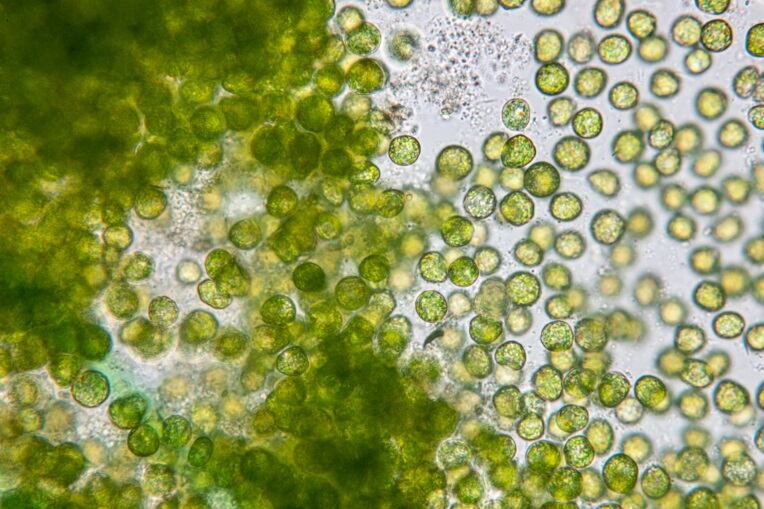 GettyImages-Shinhyu-Chlorella-vulgaris.jpg
