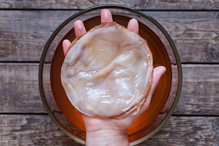 Do consumers expect kombucha to contain live organisms? Court gives green light to lawsuit