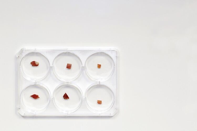 meat-TopMicrobialStock.jpg