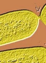 Listeria monocytogenes: One of the most virulent foodborne pathogens