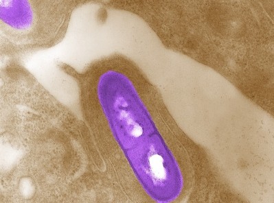 Listeria monocytogenes (pictured above) is one of four major foodborne pathogens targeted by IFSAC.