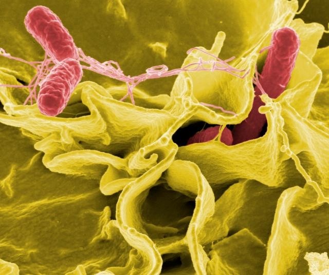 FoodNet report reveals US foodborne illness targets not being met