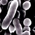 Focus on food contact surfaces, advises Canadian listeria expert
