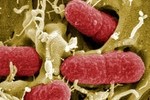 Canada ploughs $1.6m into E.coli research