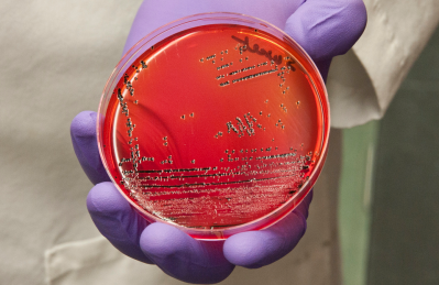 Photo: FDA/Michael J. Ermarth. Salmonella bacteria in a petri dish 