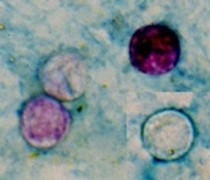 400 sick from cyclospora, Taylor Farms names as the source in two states. Picture: CDC