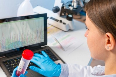 US and Canada doing Whole Genome Sequencing but without a combined bioinformatics infrastructure, said McAlpine and Robach. Pic: ©iStock/luchschen 
