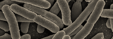 Estimates place cost of E.coli O157 infections at $240m/year in Canada 