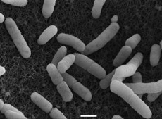 Picture copyright: Gudrun Holland, Michael Laue/RKI. EHEC bacteria, O104:H4 outbreak strain. Scanning electron microscopy. Bar: 1 µm