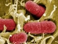 Norhern Ireland E.coli outbreak